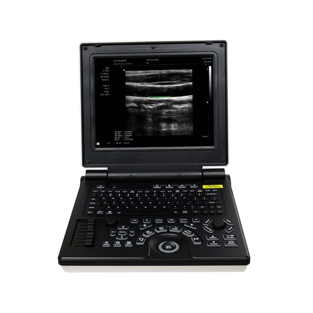 Ultrassom Doppler colorido para laptop (LCUS) A024A-N 